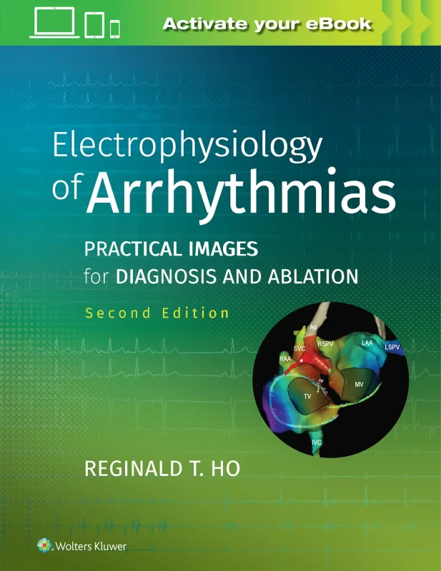 Coperta cărții "Electrophysiology of Arrhythmias: Practical Images for Diagnosis and Ablation" de autor necunoscut