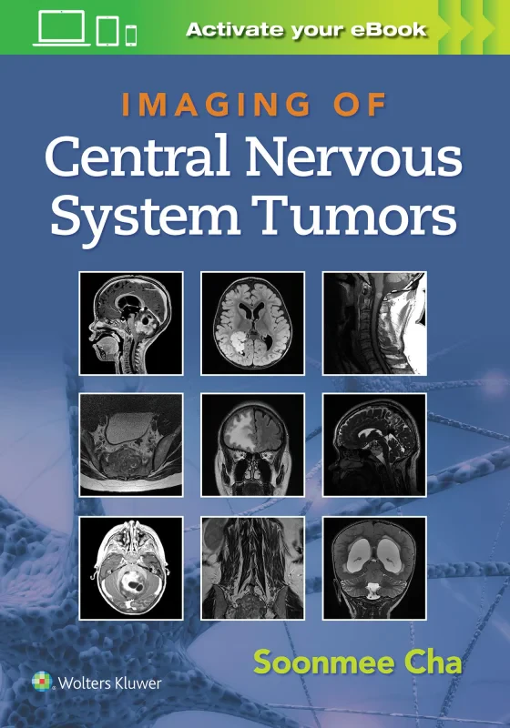 Coperta cărții "Imaging of Central Nervous System Tumors" de autor necunoscut