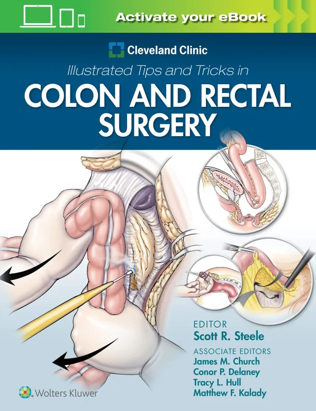 Coperta cărții "Cleveland Clinic Illustrated Tips and Tricks in Colon and Rectal Surgery" de autor necunoscut