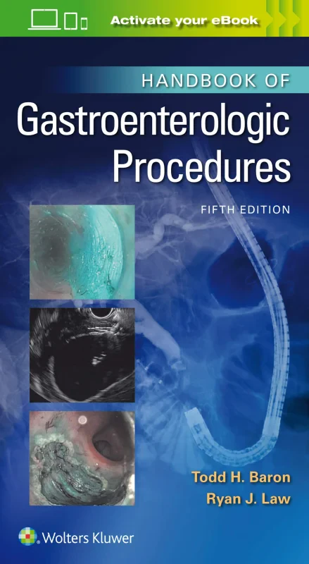 Coperta cărții "Handbook of Gastroenterologic Procedures" de autor necunoscut