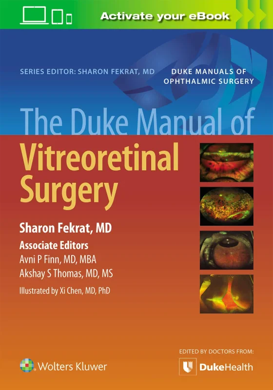 Coperta cărții "The Duke Manual of Vitreoretinal Surgery" de autor necunoscut