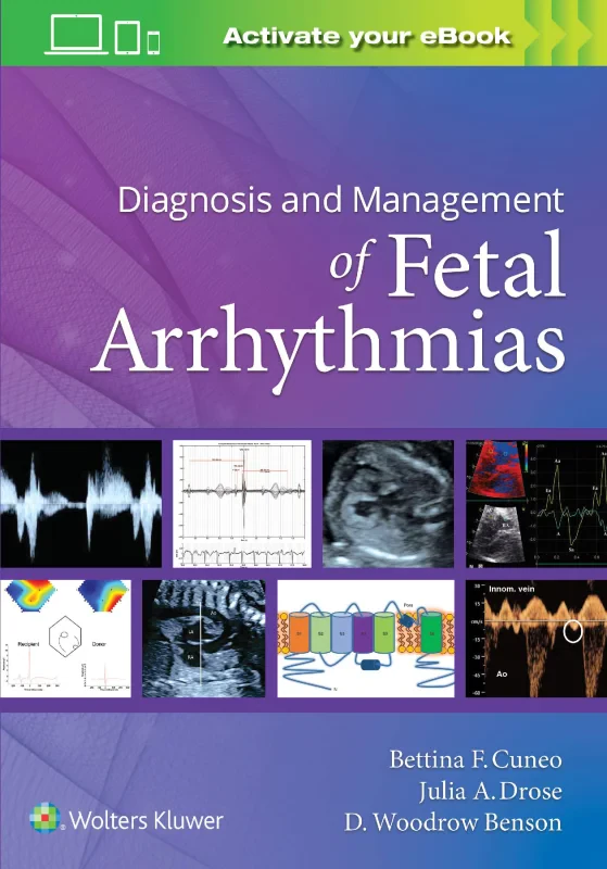Coperta cărții "Diagnosis and Management of Fetal Arrhythmias" de autor necunoscut