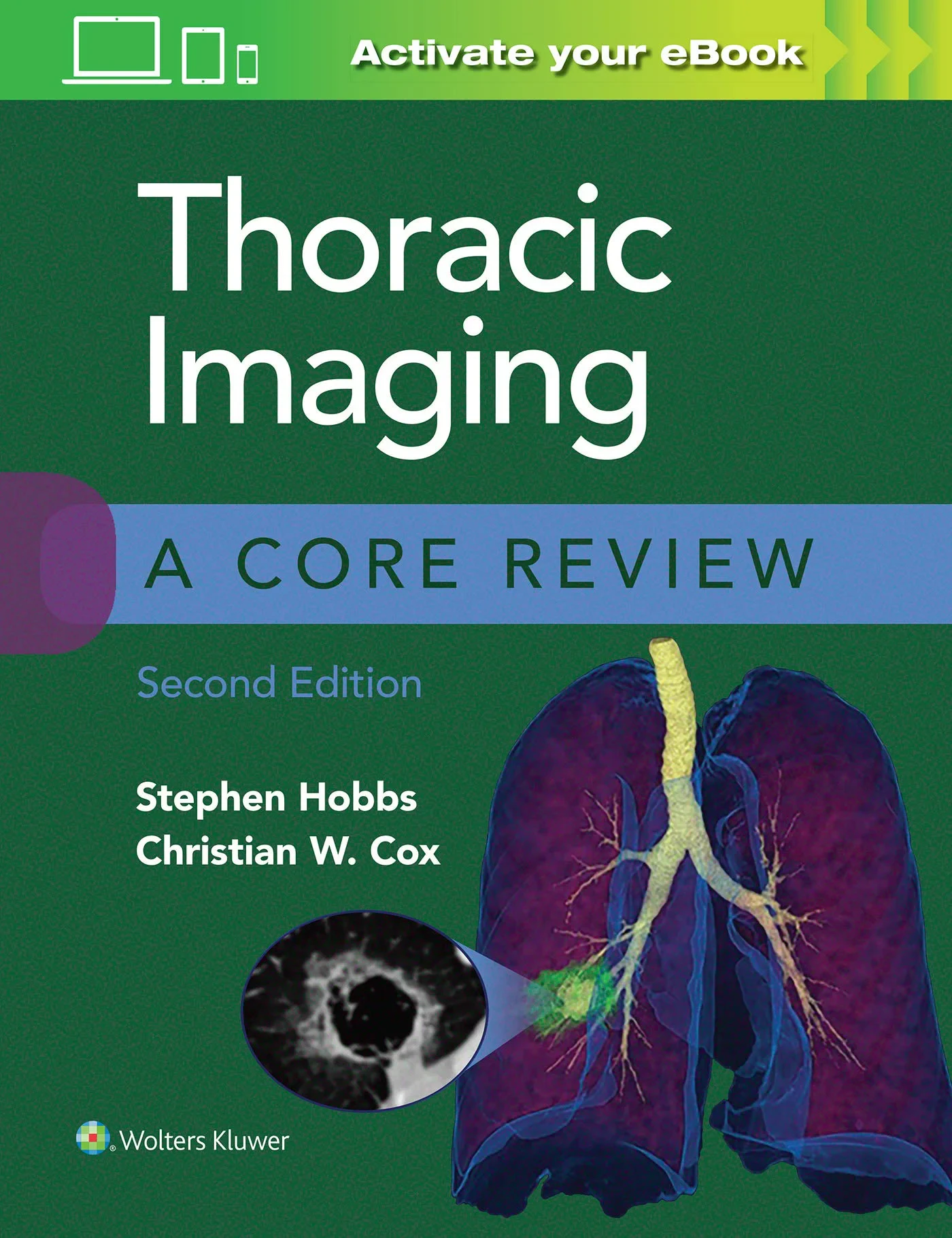 Coperta cărții "Thoracic Imaging: A Core Review" de autor necunoscut