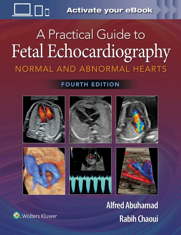 Coperta cărții "A Practical Guide to Fetal Echocardiography: Normal and Abnormal Hearts" de autor necunoscut