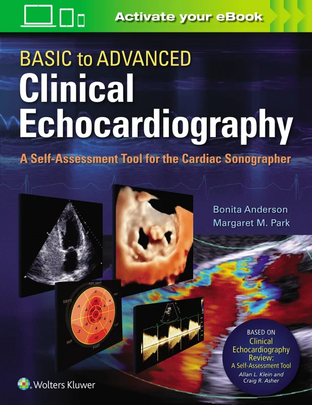 Coperta cărții "Basic to Advanced Clinical Echocardiography:A Self-Assessment Tool for the Cardiac Sonographer" de autor necunoscut