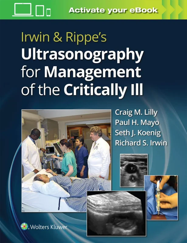 Coperta cărții "Irwin &amp; Rippe&amp;#146;s Ultrasonography for Management of the Critically Ill" de autor necunoscut