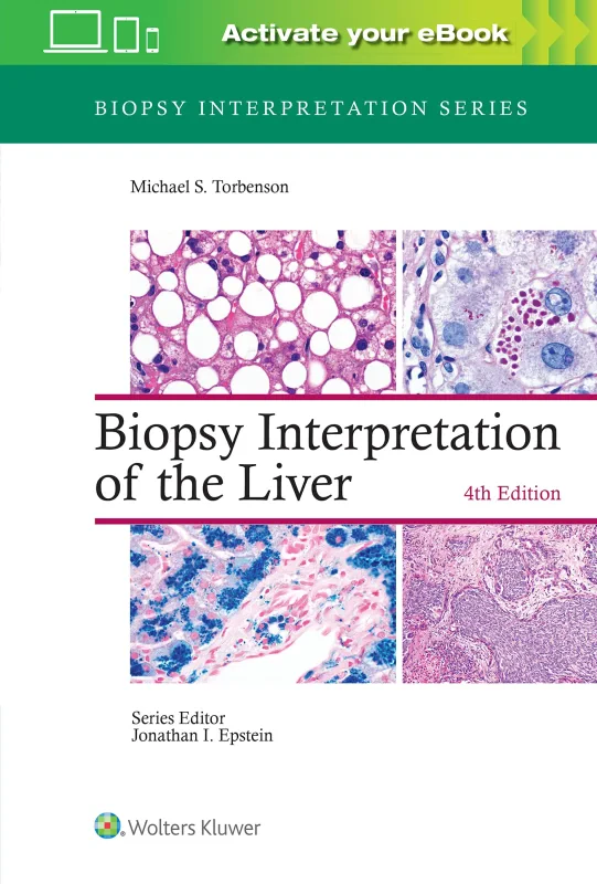 Coperta cărții "Biopsy Interpretation of the Liver 4th edition" de autor necunoscut