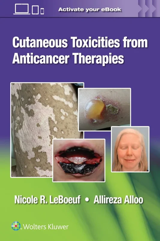 Coperta cărții "Cutaneous Reactions from Anti-Cancer Therapies" de autor necunoscut
