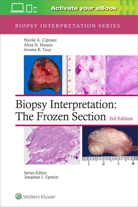 Coperta cărții "Biopsy Interpretation: The Frozen Section" de autor necunoscut