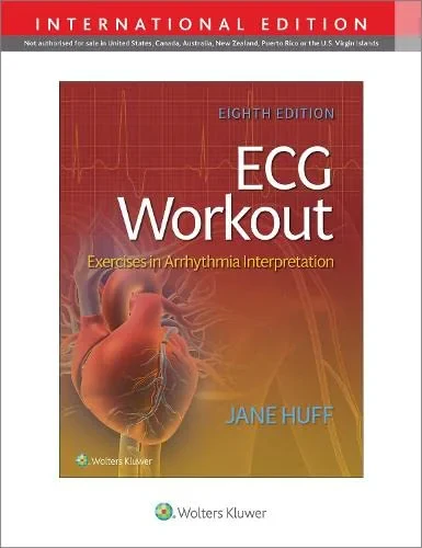 Coperta cărții "ECG Workout" de autor necunoscut