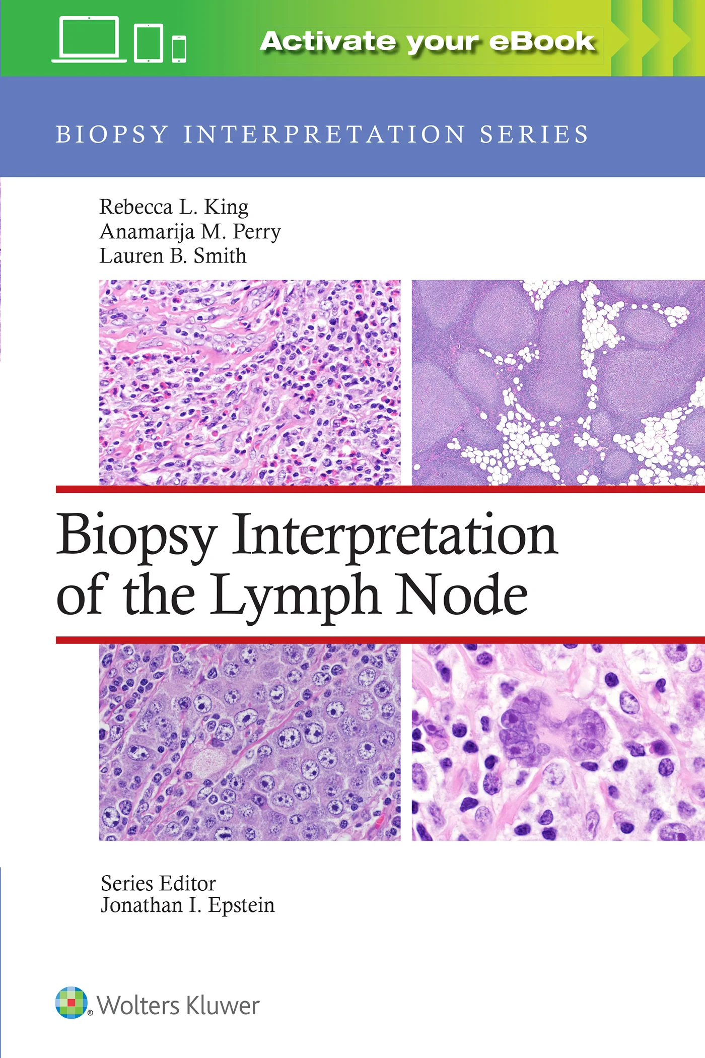 Coperta cărții "Biopsy Interpretation of the Lymph Node" de autor necunoscut