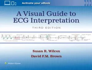 Coperta cărții "A Visual Guide to ECG Interpretation" de autor necunoscut