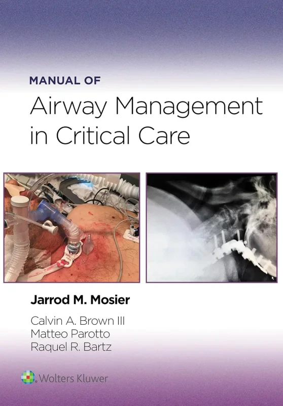 Coperta cărții "Manual of Airway Management in Critical Care" de autor necunoscut