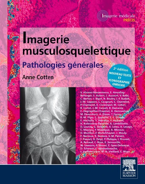 Imagerie musculosquelettique : pathologies g?n?ral...
