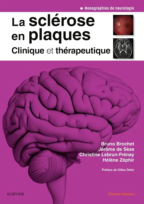 La scl?rose en plaques - Clinique et th?rapeutique