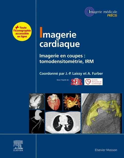 Imagerie cardiaque