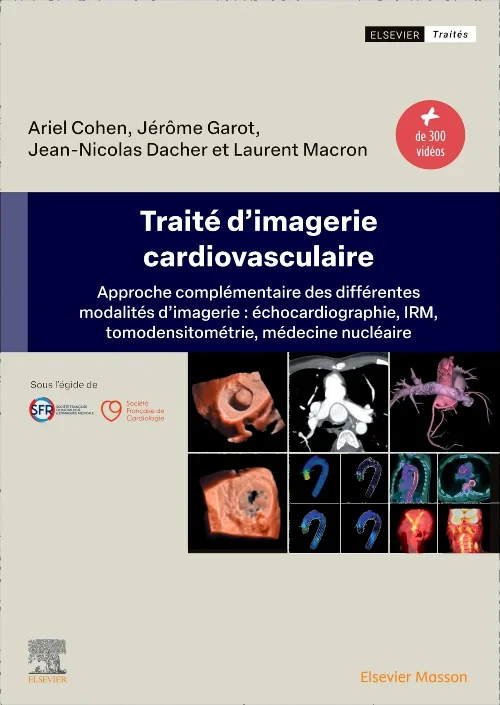 Traité d'imagerie cardiovasculaire