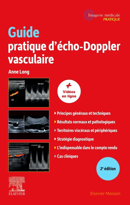 Guide pratique d'écho-Doppler vasculaire