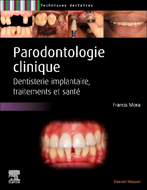 Parodontologie clinique
