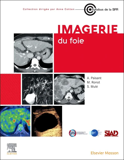 Imagerie du foie