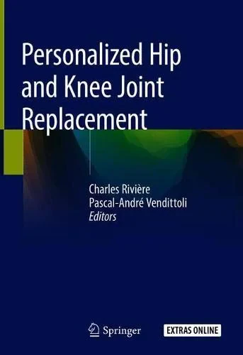Coperta cărții "Personalized Hip and Knee Joint Replacement" de autor necunoscut