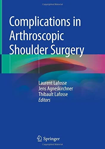 Coperta cărții "Complications in Arthroscopic Shoulder Surgery" de autor necunoscut