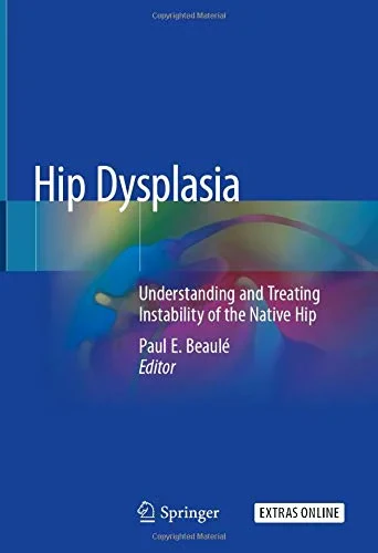 Coperta cărții "Hip Dysplasia: Understanding and Treating Instability of the Native Hip" de autor necunoscut