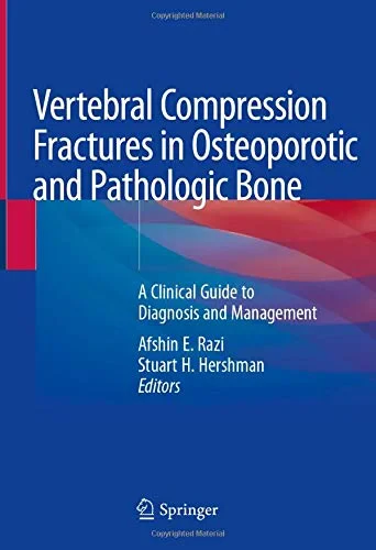 Coperta cărții "Spinal Compression Fractures in Osteoporotic and Pathologic Bone: A Clinical Guide to Diagnosis and Management" de autor necunoscut