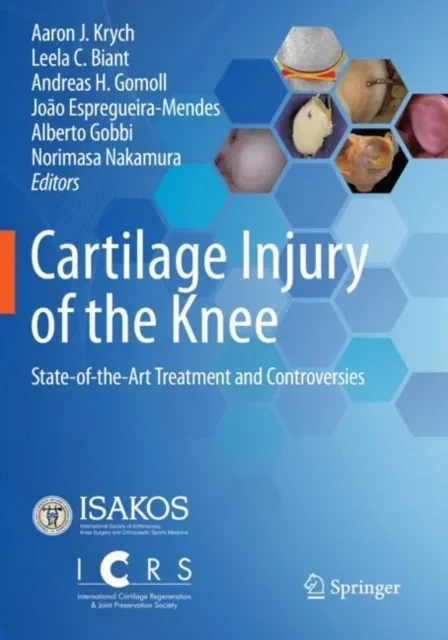 Coperta cărții "Cartilage Injury of the Knee" de autor necunoscut