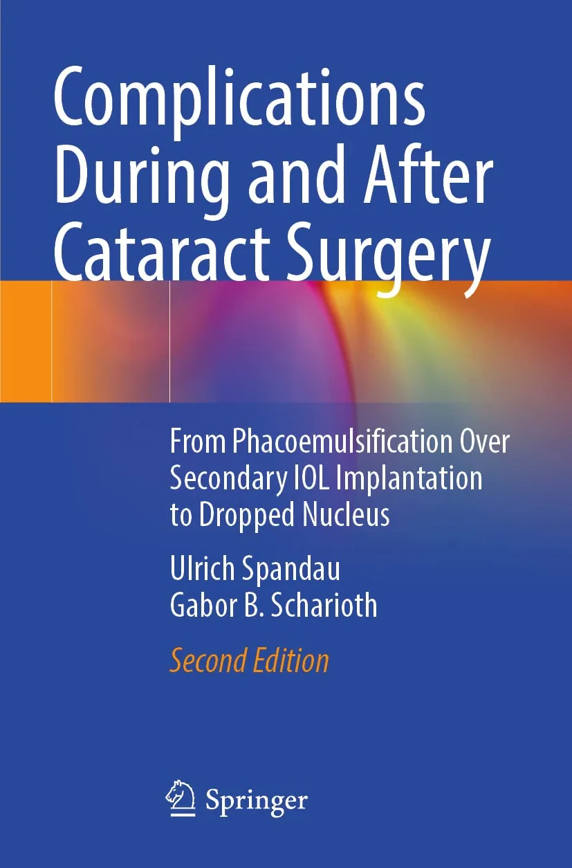 Coperta cărții "Complications During and After Cataract Surgery. From Phacoemulsification Over Secondary IOL Implantation to Dropped Nucleus" de autor necunoscut