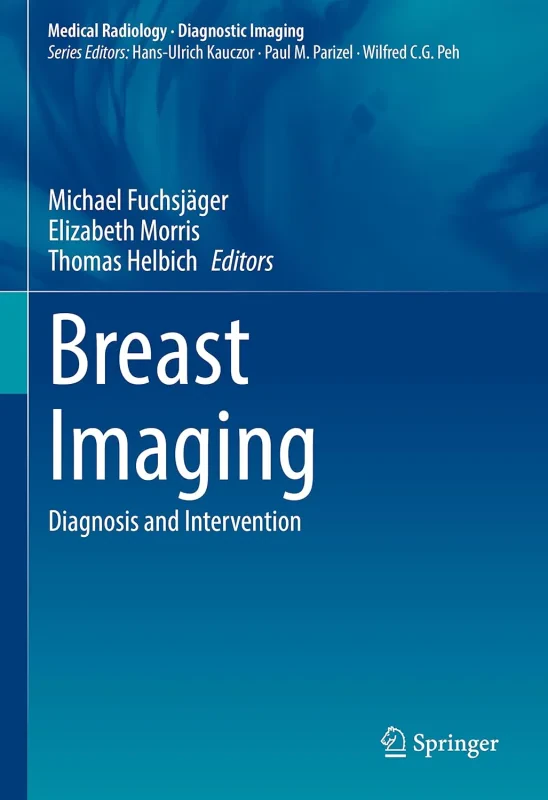 Coperta cărții "Breast Imaging. Diagnosis and Intervention" de autor necunoscut