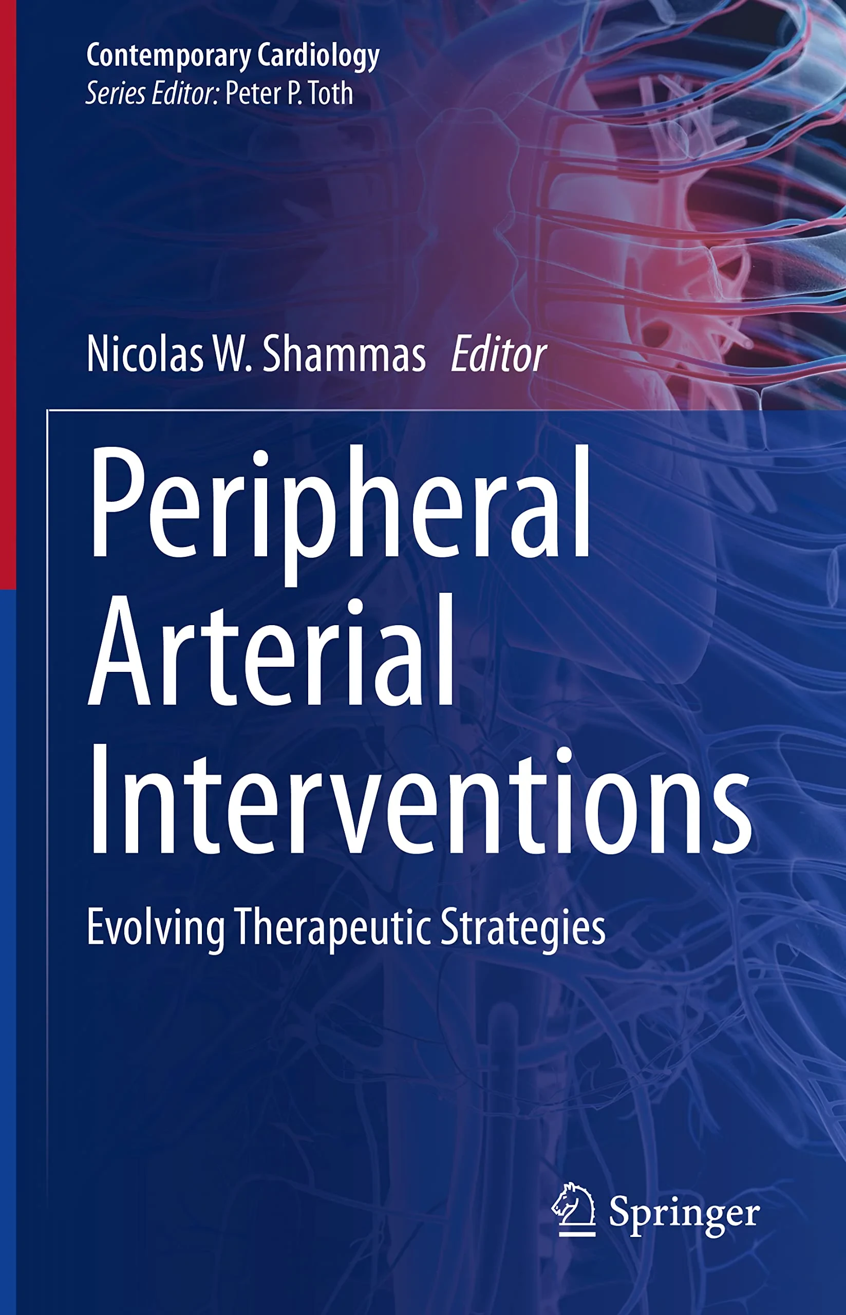 Coperta cărții "Peripheral Arterial Interventions" de autor necunoscut