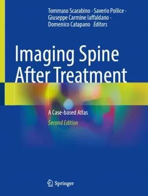 Coperta cărții "Imaging Spine After Treatment: A Case-based Atlas" de autor necunoscut