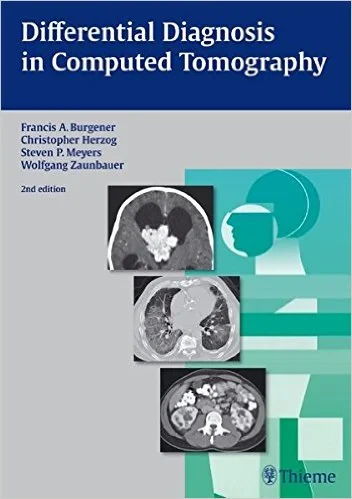 Coperta cărții "Differential Diagnosis in Computed Tomography" de autor necunoscut