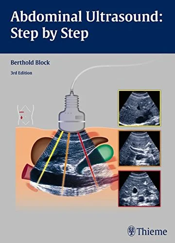 Coperta cărții "Abdominal Ultrasound: Step by Step" de autor necunoscut