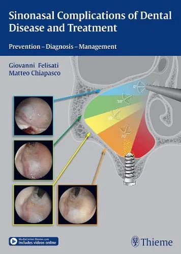 Coperta cărții "Sinonasal Complications of Dental Disease and Treatment" de autor necunoscut