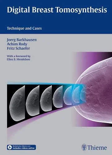 Coperta cărții "Digital Breast Tomosynthesis: Technique and Cases" de autor necunoscut
