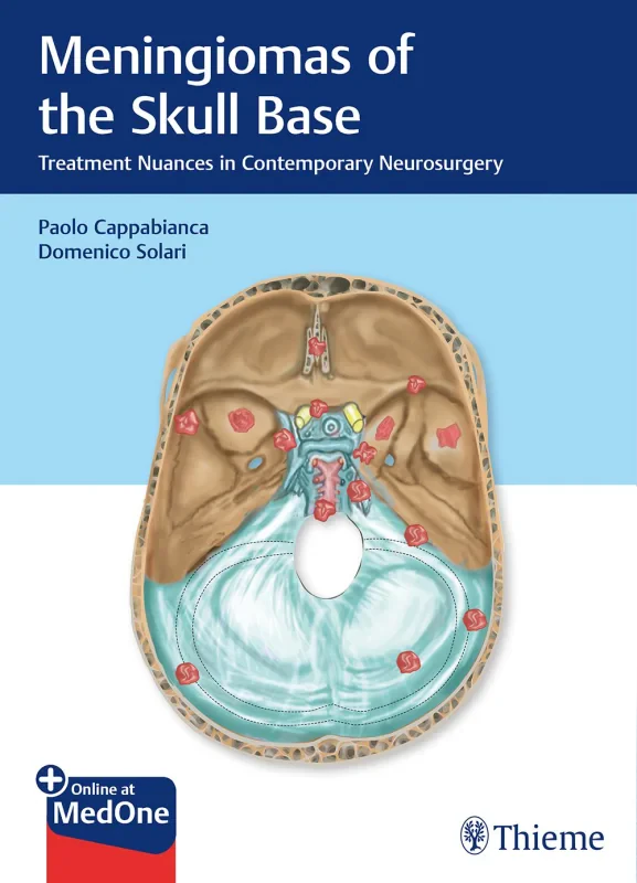 Coperta cărții "Meningiomas of the Skull Base: Treatment Nuances in Contemporary Neurosurgery" de autor necunoscut