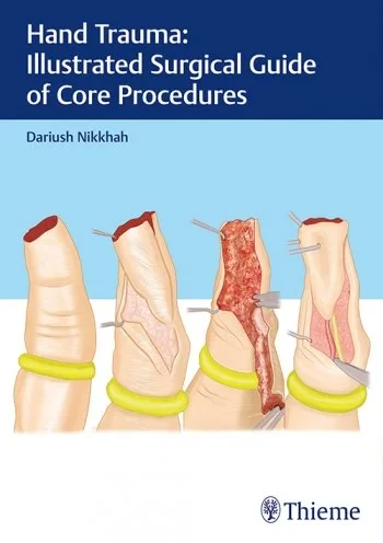Coperta cărții "Hand Trauma: Illustrated Surgical Guide of Core Procedures" de autor necunoscut