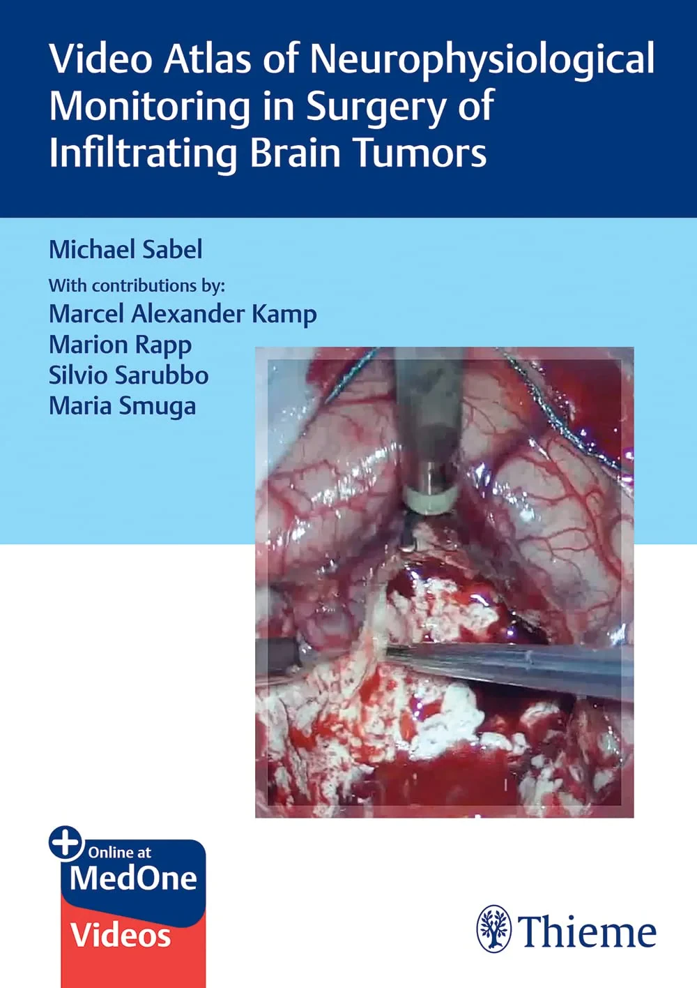 Coperta cărții "Video Atlas of Neurophysiological Monitoring in Surgery of Infiltrating Brain Tumors" de autor necunoscut