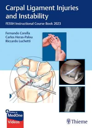 Coperta cărții "Carpal Ligament Injuries and Instability" de autor necunoscut