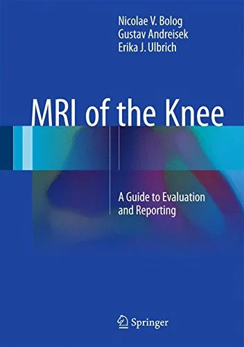 Coperta cărții "MRI of the Knee: A Guide to Evaluation and Reporting" de autor necunoscut