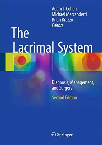 Coperta cărții "The Lacrimal System Diagnosis, Management, and Surgery, Second Edition" de autor necunoscut