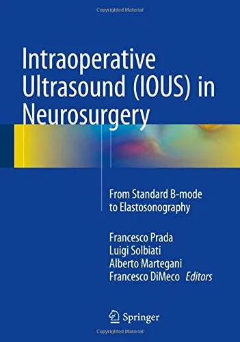 Coperta cărții "Intraoperative Ultrasound (IOUS) in Neurosurgery" de autor necunoscut