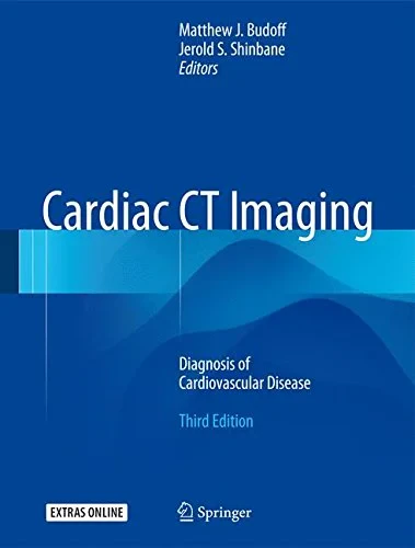 Coperta cărții "Cardiac CT Imaging: Diagnosis of Cardiovascular Disease" de autor necunoscut