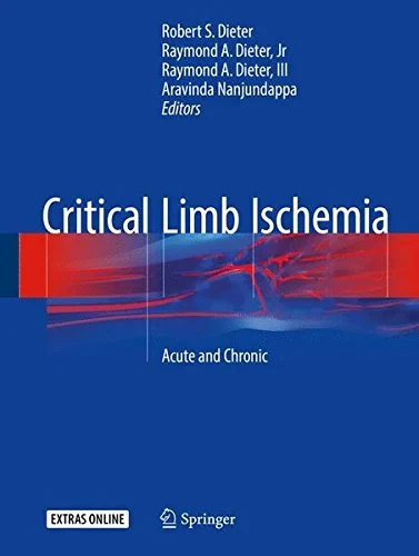 Coperta cărții "Critical Limb Ischemia: Acute and Chronic" de autor necunoscut