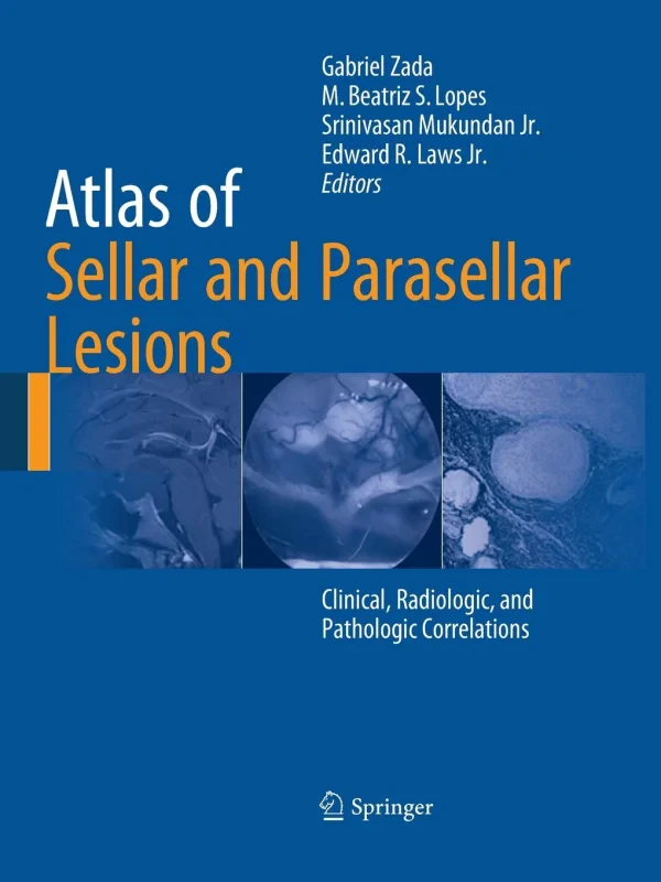 Coperta cărții "Atlas of Sellar and Parasellar Lesions" de autor necunoscut