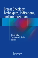Coperta cărții "Breast Oncology: Techniques, Indications, and Interpretation" de autor necunoscut