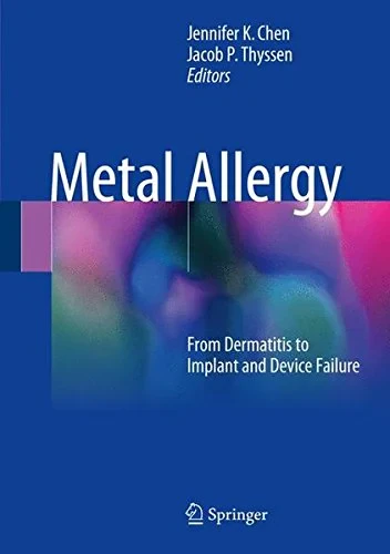 Coperta cărții "Metal Allergy: From Dermatitis to Implant and Device Failure" de autor necunoscut