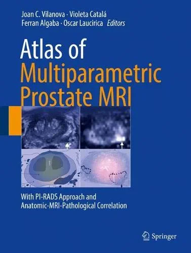 Coperta cărții "Atlas of Multiparametric Prostate MRI" de autor necunoscut